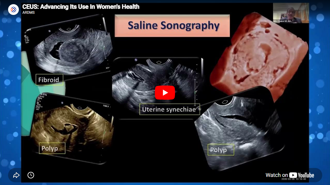 screenshot of the youtube video for the CEUS advancing its use in women's health webinar