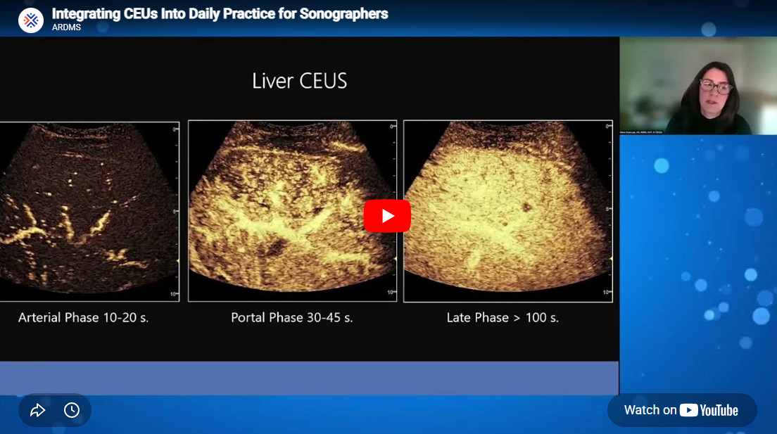 screenshot from the Integrating CEUs into daily practice for sonographers webinars